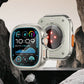✨Hot Sale 49% Off🔥Scratch-Resistance Watch Case for Series